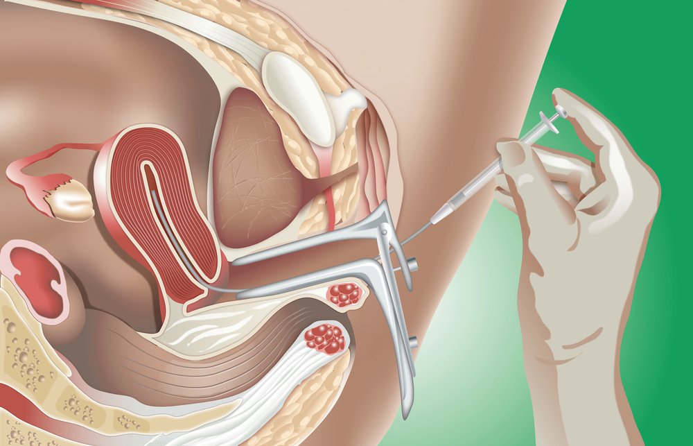 IUI Clinic in Mumbai